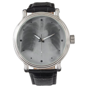 Montre de ~ de rayon du coffre X