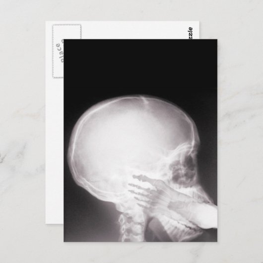 Mouth X-Ray Briefkaart (Voorkant / Achterkant)
