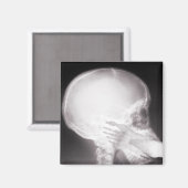 Mouth X-Ray Magneet (Voorkant / Achterkant)