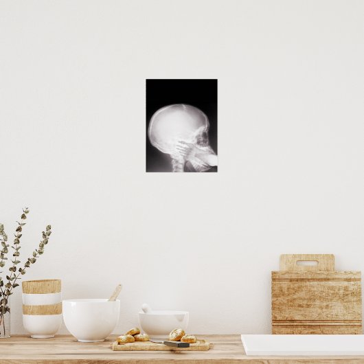 Mouth X-Ray Poster (Keuken)
