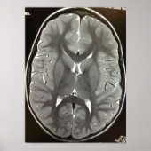 MRI Brain Poster (Voorkant)
