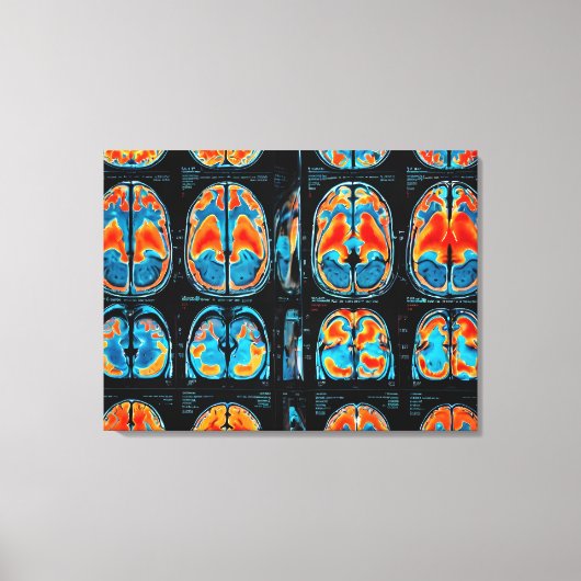 MRI hersenscan Canvas Afdruk (Voorkant)