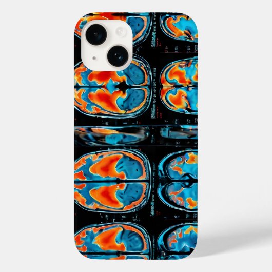 MRI-hersenscan Case-Mate iPhone Case (Achterkant)