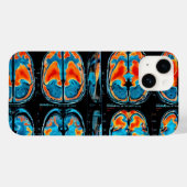 MRI-hersenscan Case-Mate iPhone Case (Achterkant (horizontaal))