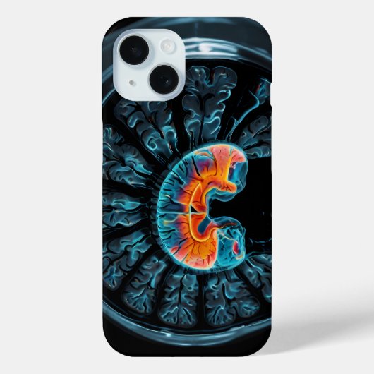 MRI-hersenscan Case-Mate iPhone Case (Achterkant)