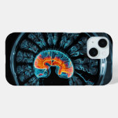 MRI-hersenscan Case-Mate iPhone Case (Achterkant (horizontaal))