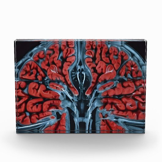 MRI hersenscan Fotoblokken (Voorkant)