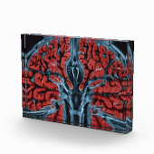 MRI hersenscan Fotoblokken (Rechts)