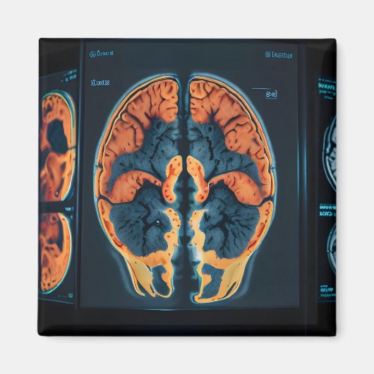 MRI hersenscan Magneet (Voorkant)