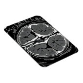 MRI hersenscan Magneet (Rechterzijde)