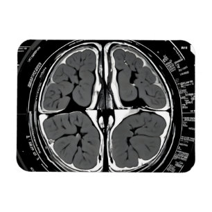 MRI hersenscan Magneet