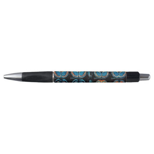 MRI hersenscan Pen (Voorkant)