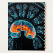 MRI hersenscan Planner (Achterkant)