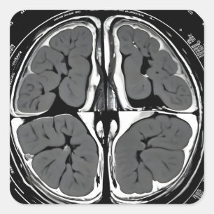 MRI hersenscan Vierkante Sticker