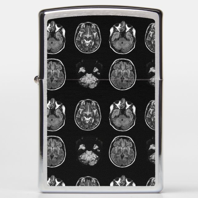 MRI-scan van Brain (Voorkant)