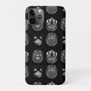 MRI-scan van Brain iPhone 11 Pro Hoesje