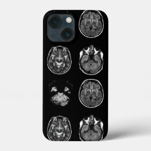 MRI-scan van Brain iPhone 13 Mini Hoesje