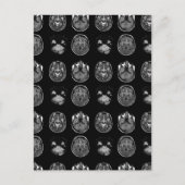 MRI-scan van Brain Feestdagenkaart (Voorkant)