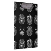 MRI-scan van Brain Klembord (Rechts)