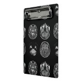 MRI-scan van Brain Mini Klembord (Angled2)