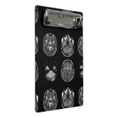 MRI-scan van Brain Mini Klembord (Schuin)