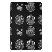 MRI-scan van Brain Mini Klembord (Achterkant)