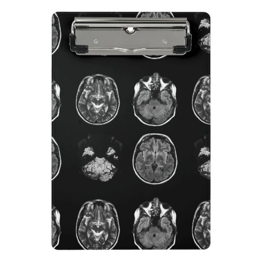 MRI-scan van Brain Mini Klembord (Voorkant)