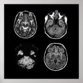 MRI-scan van Brain Poster (Voorkant)