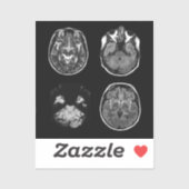 MRI-scan van Brain Sticker (Vel)
