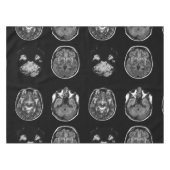 MRI-scan van Brain Tafelkleed (Voorkant (Horizontaal))