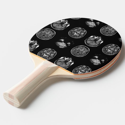 MRI-scan van Brain Tafeltennisbatje (Voorkant Gekanteld)