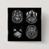 MRI-scan van Brain Vierkante Button 5,1 Cm (Voorkant)