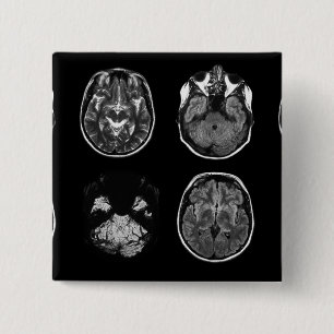 MRI-scan van Brain Vierkante Button 5,1 Cm