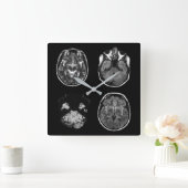 MRI-scan van Brain Vierkante Klok (Huis)