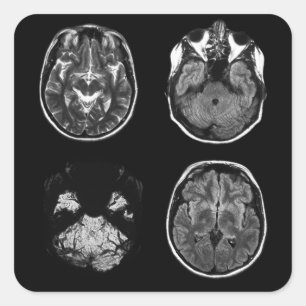 MRI-scan van Brain Vierkante Sticker