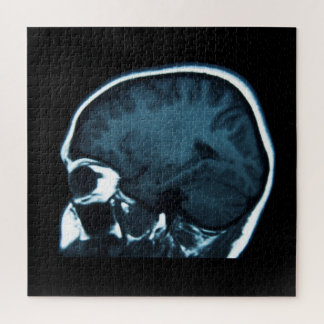 MRI-scan van hersenen Röntgenfoto Legpuzzel