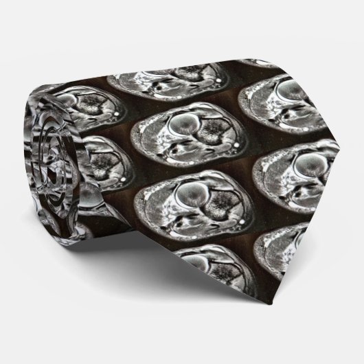 MRI-STROPDAS STROPDAS (Opgerold)