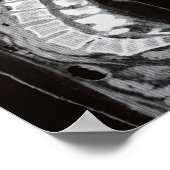 MRI van de wervelkolom Poster (Hoek)