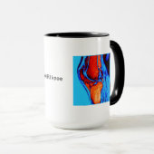 MRI van knie Mok (Voorkant rechts)