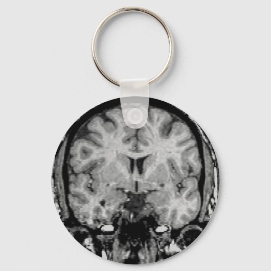 MRI voor brein, coronaal segment Sleutelhanger (Voorkant)