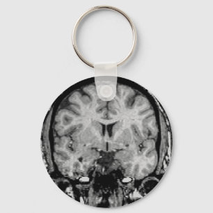 MRI voor hersenen, coronaal segment Sleutelhanger