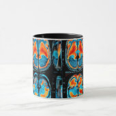 Mug Analyse cérébrale par IRM (Centre)