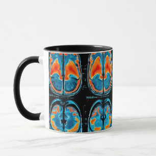 Mug Analyse cérébrale par IRM