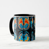 Mug Analyse cérébrale par IRM (Devant gauche)