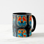 Mug Analyse cérébrale par IRM (Devant droit)