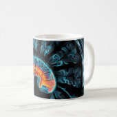 Mug Analyse cérébrale par IRM (Devant droit)