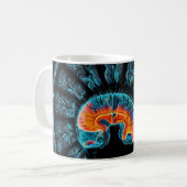 Mug Analyse cérébrale par IRM (Devant gauche)