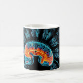 Mug Analyse cérébrale par IRM (Centre)
