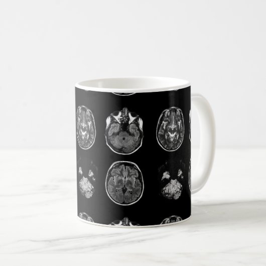 Mug Analyse IRM du cerveau (Devant droit)
