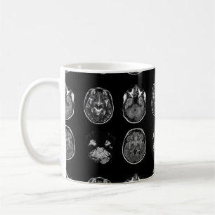 Mug Analyse IRM du cerveau
